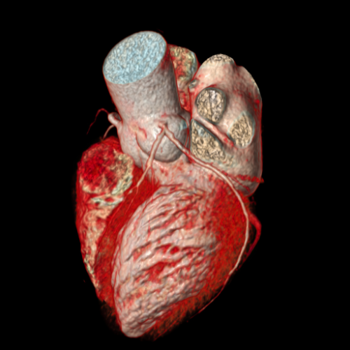 heart age test UK