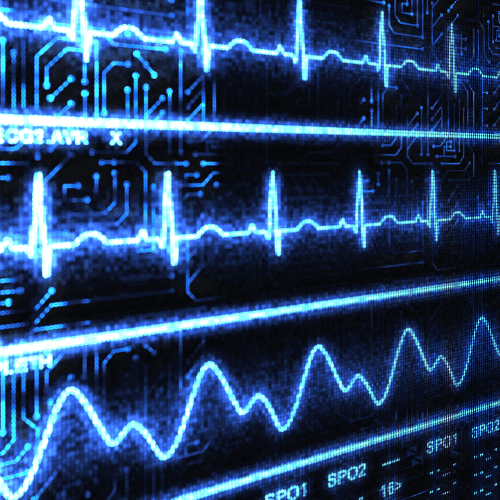 ECG test Surrey